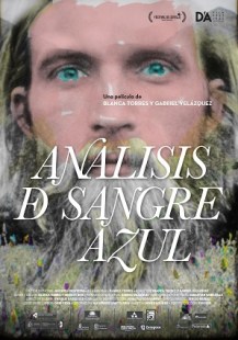 analisis-de-sangre-azul-web